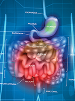 Quick Quiz: Colorectal cancer